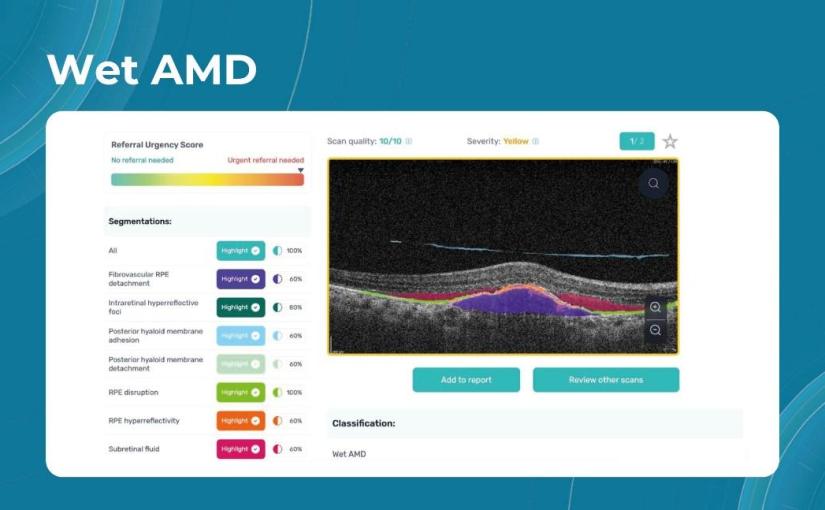 Eye Check Up with AI: Why Optometrists Start Using&nbsp;Technologies